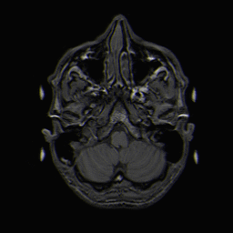 Genuine animated T1-weighted axial MRI sequence of a normal brain